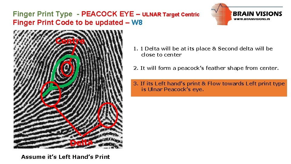 Finger Print Type - PEACOCK EYE – ULNAR Target Centric Finger Print Code to