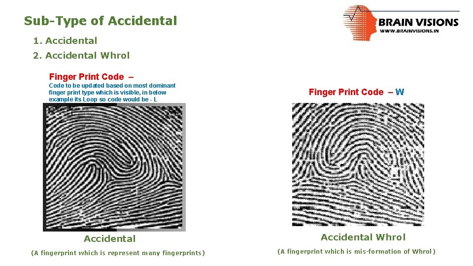 Sub-Type of Accidental 1. Accidental 2. Accidental Whrol Finger Print Code – Code to