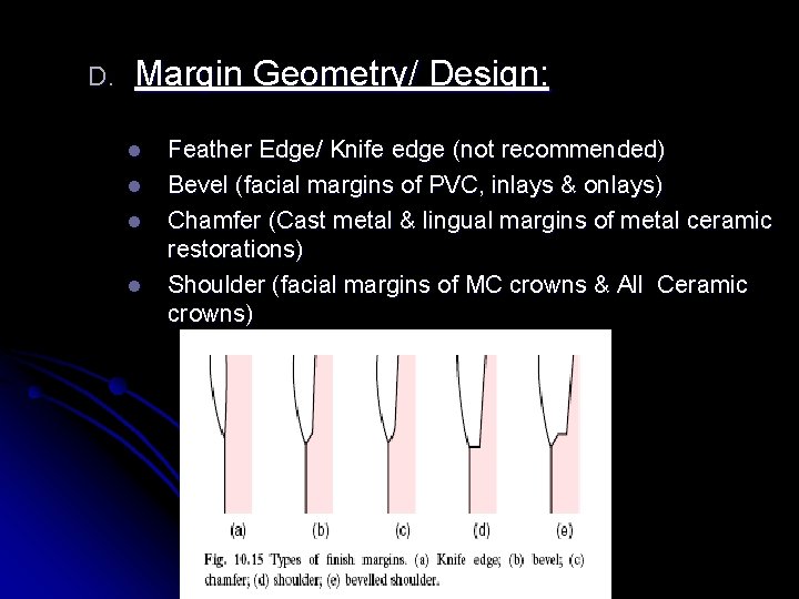 D. Margin Geometry/ Design: l l Feather Edge/ Knife edge (not recommended) Bevel (facial