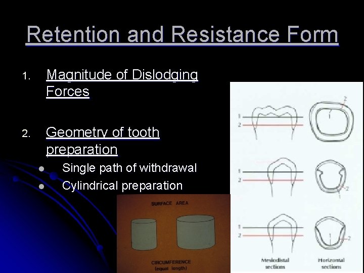 Retention and Resistance Form 1. Magnitude of Dislodging Forces 2. Geometry of tooth preparation