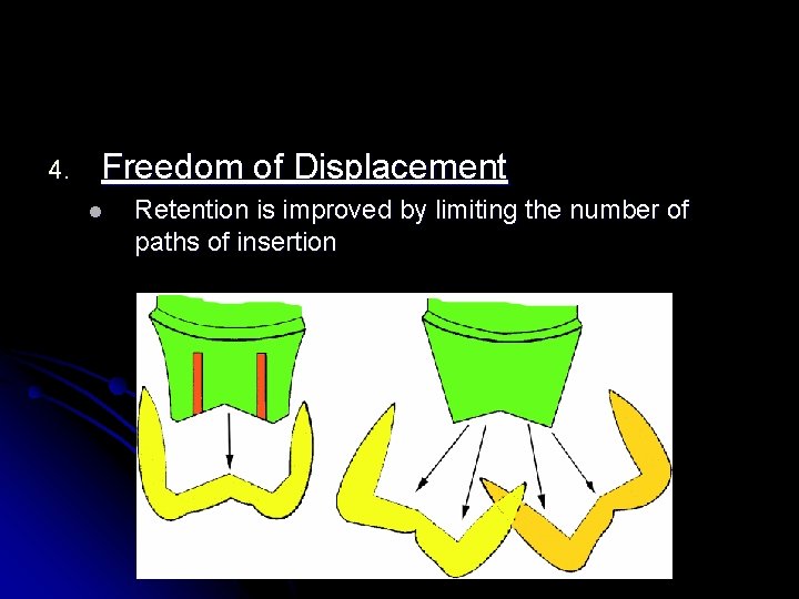 4. Freedom of Displacement l Retention is improved by limiting the number of paths