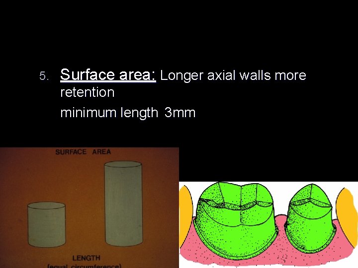 5. Surface area: Longer axial walls more retention minimum length 3 mm 