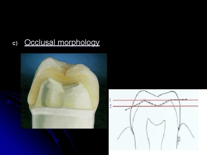 c) Occlusal morphology 
