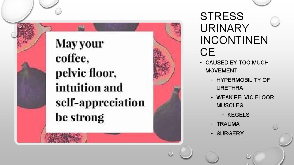 STRESS URINARY INCONTINEN CE • CAUSED BY TOO MUCH MOVEMENT • HYPERMOBILITY OF URETHRA