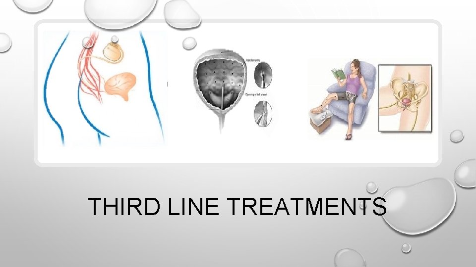 THIRD LINE TREATMENTS 