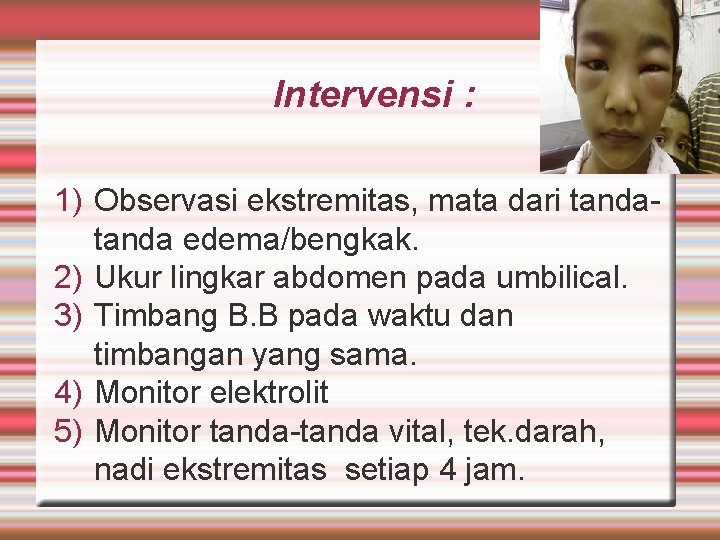 Intervensi : 1) Observasi ekstremitas, mata dari tanda edema/bengkak. 2) Ukur lingkar abdomen pada