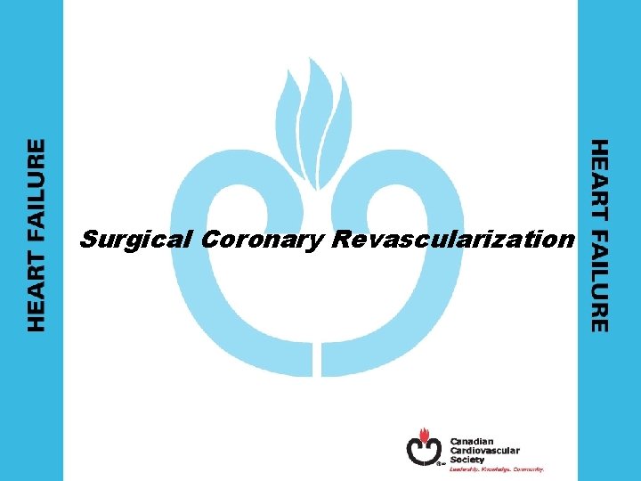 Surgical Coronary Revascularization 