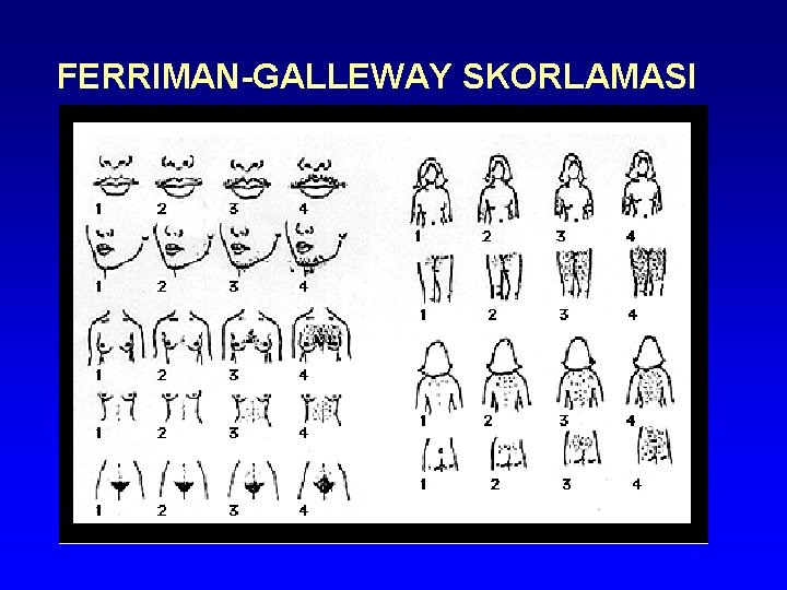 FERRIMAN-GALLEWAY SKORLAMASI FERRIMAN-GALLEWAY SKORLAMASI