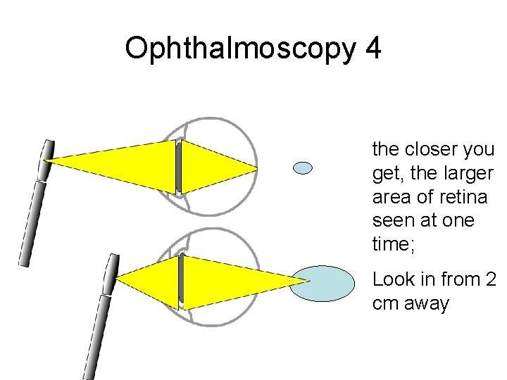 Ophthalmoscopy 4 the closer you get, the larger area of retina seen at one