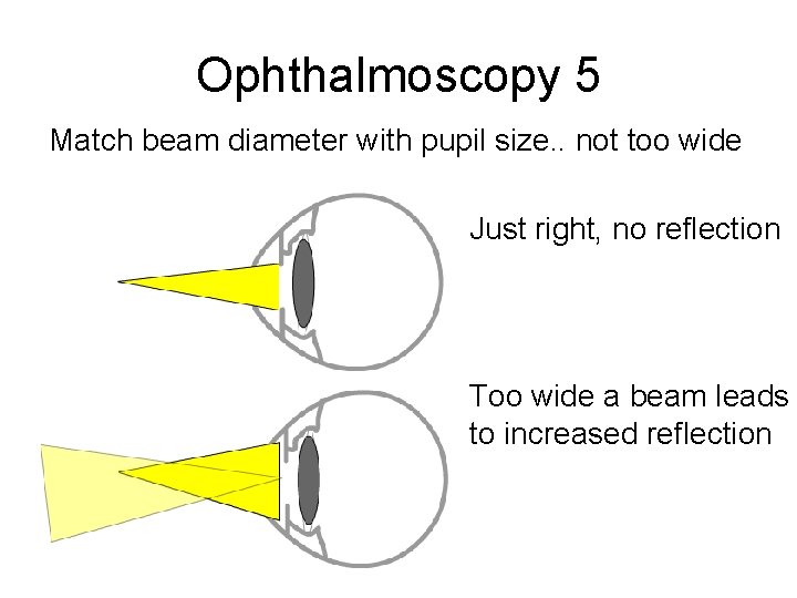 Ophthalmoscopy 5 Match beam diameter with pupil size. . not too wide Just right,
