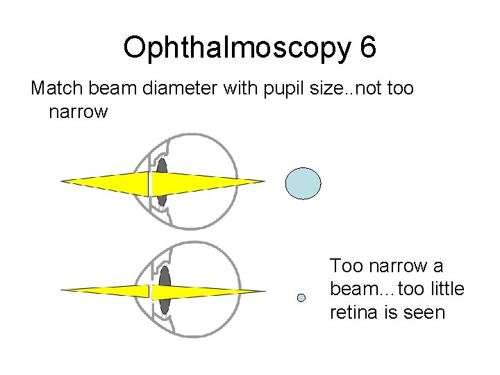 Ophthalmoscopy 6 Match beam diameter with pupil size. . not too narrow Too narrow