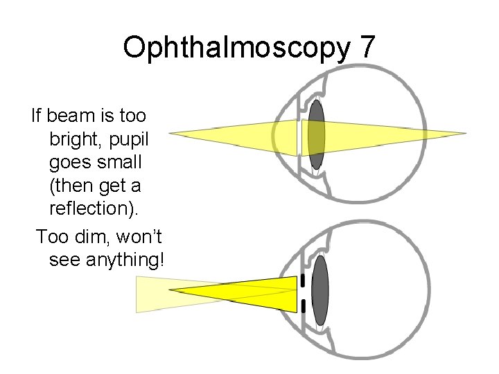 Ophthalmoscopy 7 If beam is too bright, pupil goes small (then get a reflection).