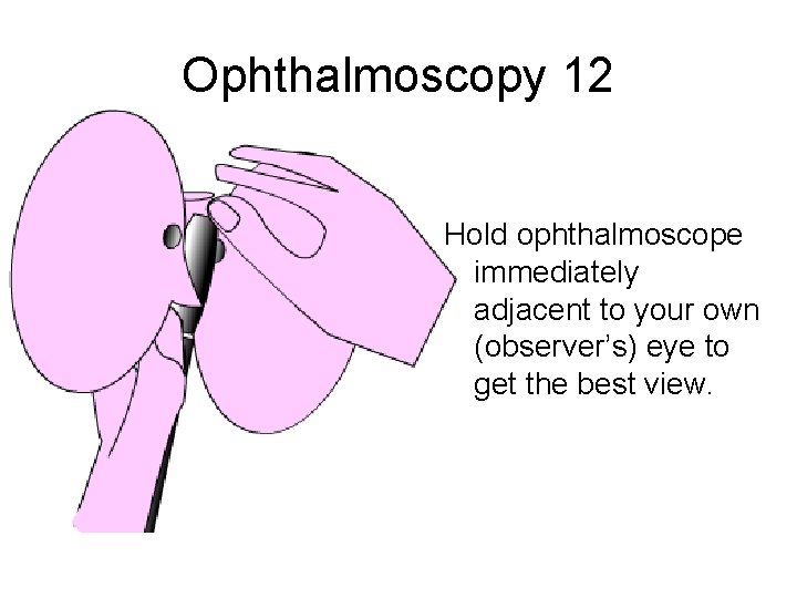 Ophthalmoscopy 12 Hold ophthalmoscope immediately adjacent to your own (observer’s) eye to get the