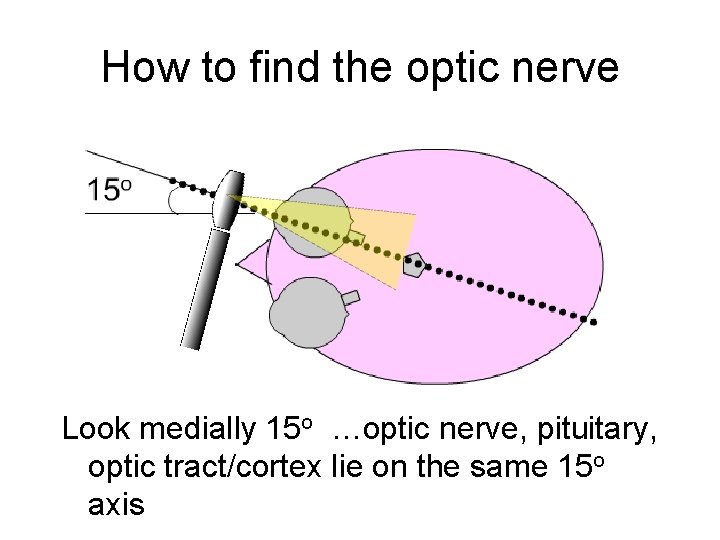 How to find the optic nerve Look medially 15 o …optic nerve, pituitary, optic