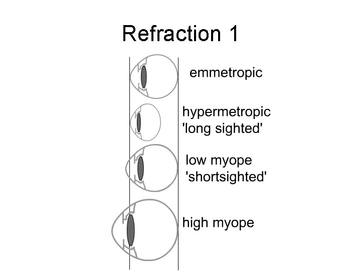 Refraction 1 