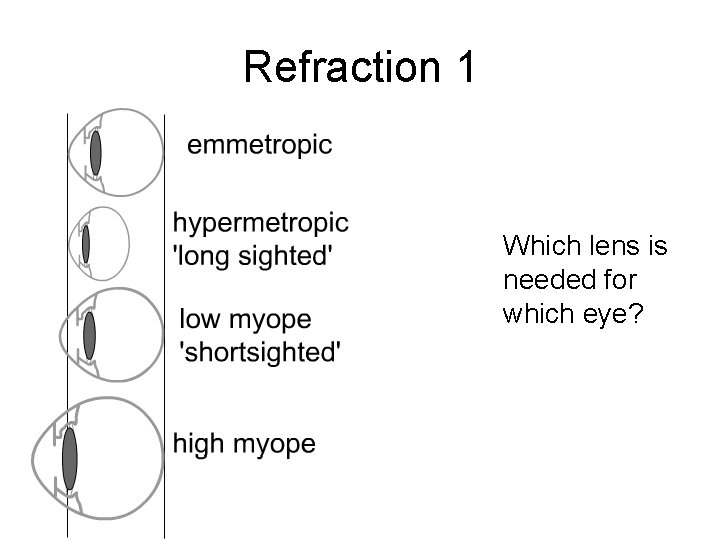 Refraction 1 Which lens is needed for which eye? 