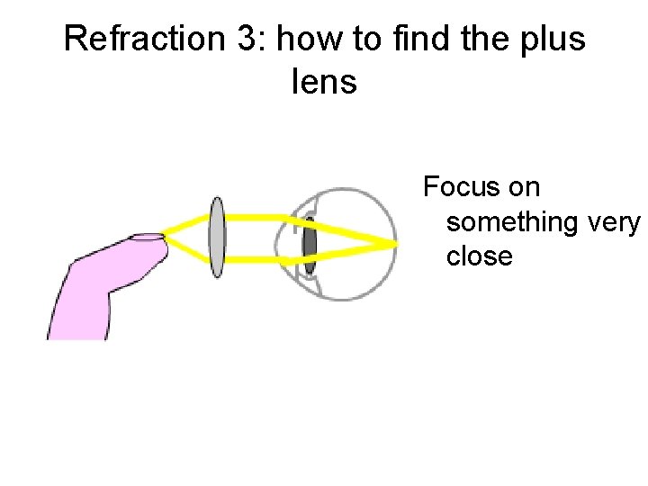 Refraction 3: how to find the plus lens Focus on something very close 