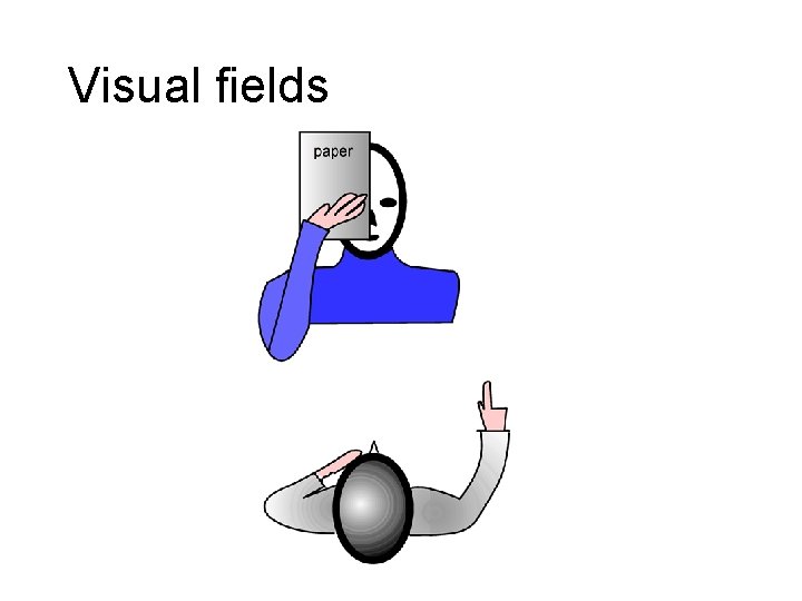 Visual fields 