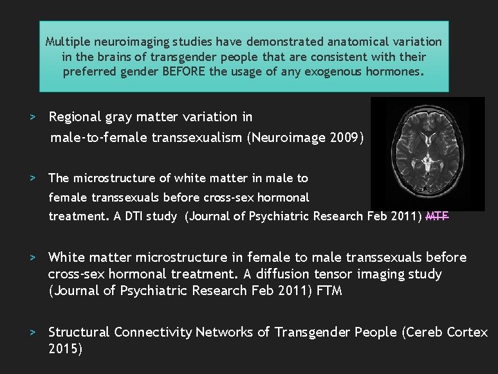 Multiple neuroimaging studies have demonstrated anatomical variation in the brains of transgender people that