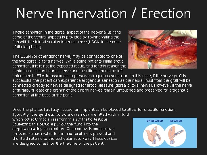 Nerve Innervation / Erection Tactile sensation in the dorsal aspect of the neo-phallus (and