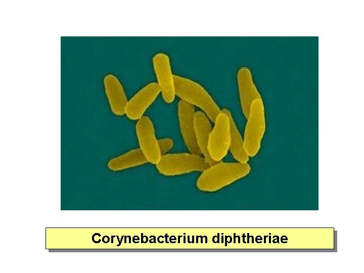 Corynebacterium diphtheriae 