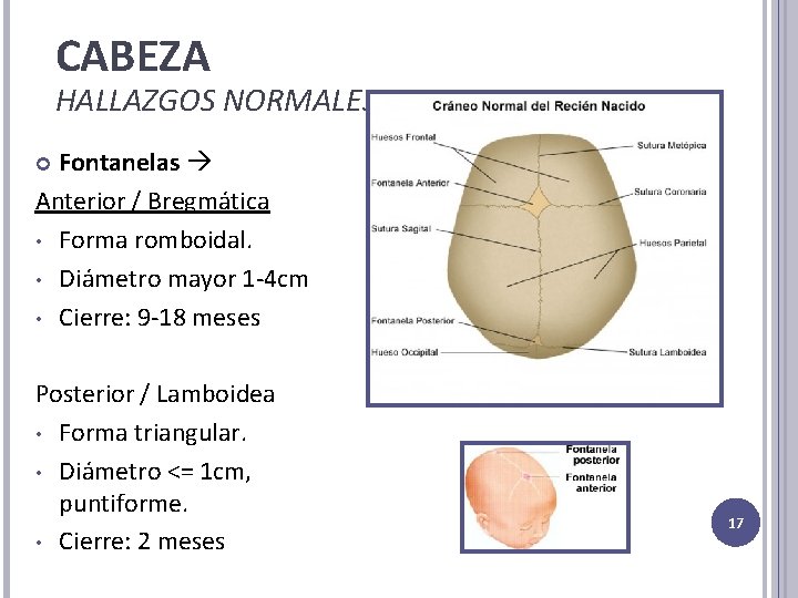 CABEZA HALLAZGOS NORMALES Fontanelas Anterior / Bregmática • Forma romboidal. • Diámetro mayor 1