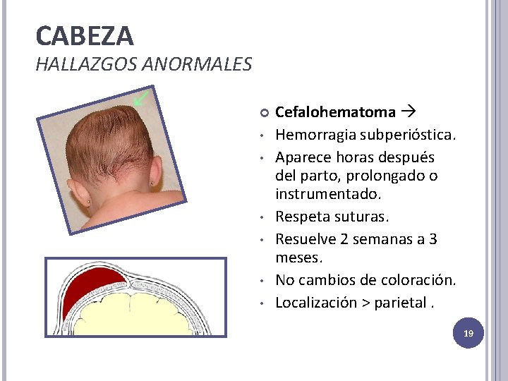 CABEZA HALLAZGOS ANORMALES • • • Cefalohematoma Hemorragia subperióstica. Aparece horas después del parto,