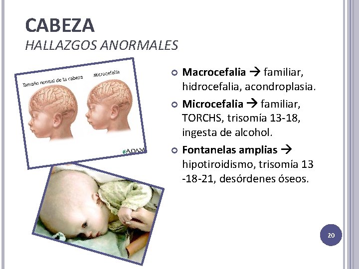 CABEZA HALLAZGOS ANORMALES Macrocefalia familiar, hidrocefalia, acondroplasia. Microcefalia familiar, TORCHS, trisomía 13 -18, ingesta