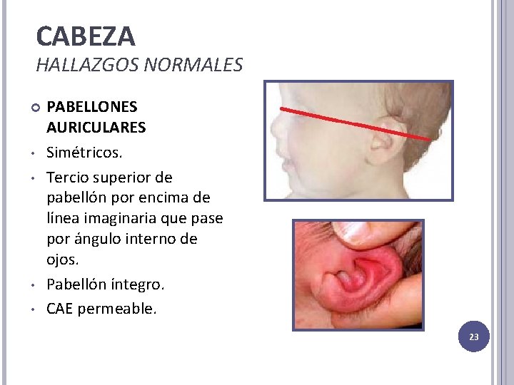 CABEZA HALLAZGOS NORMALES • • PABELLONES AURICULARES Simétricos. Tercio superior de pabellón por encima