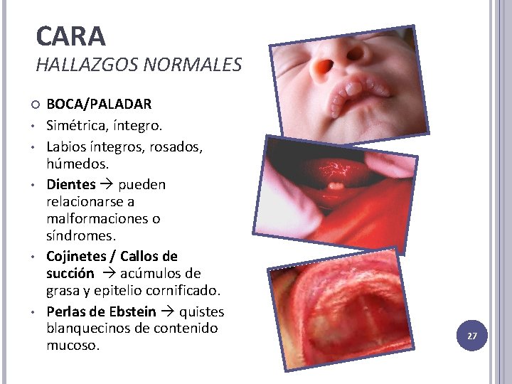 CARA HALLAZGOS NORMALES • • • BOCA/PALADAR Simétrica, íntegro. Labios íntegros, rosados, húmedos. Dientes