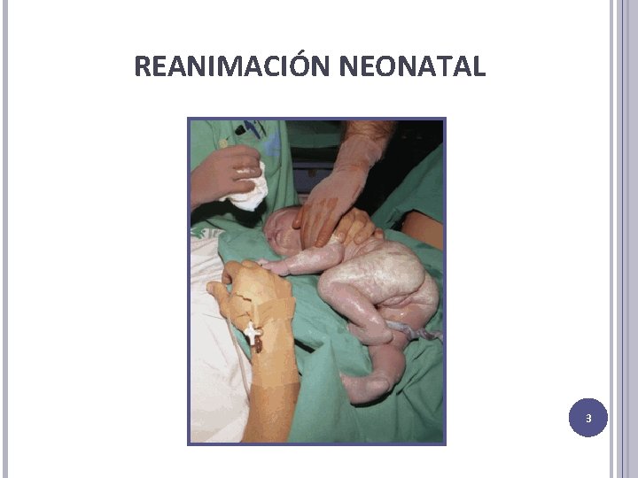 REANIMACIÓN NEONATAL 3 