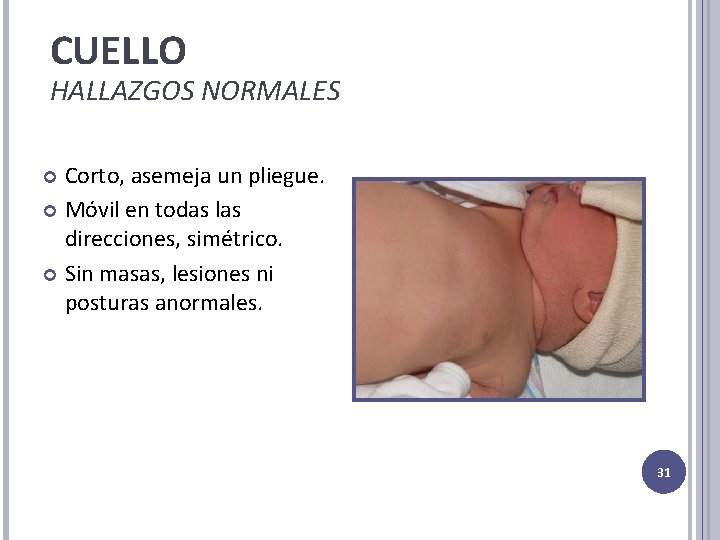 CUELLO HALLAZGOS NORMALES Corto, asemeja un pliegue. Móvil en todas las direcciones, simétrico. Sin