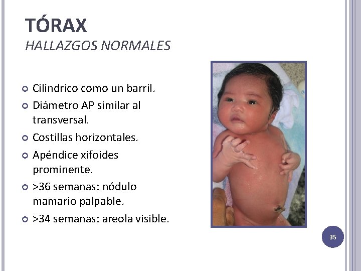 TÓRAX HALLAZGOS NORMALES Cilíndrico como un barril. Diámetro AP similar al transversal. Costillas horizontales.