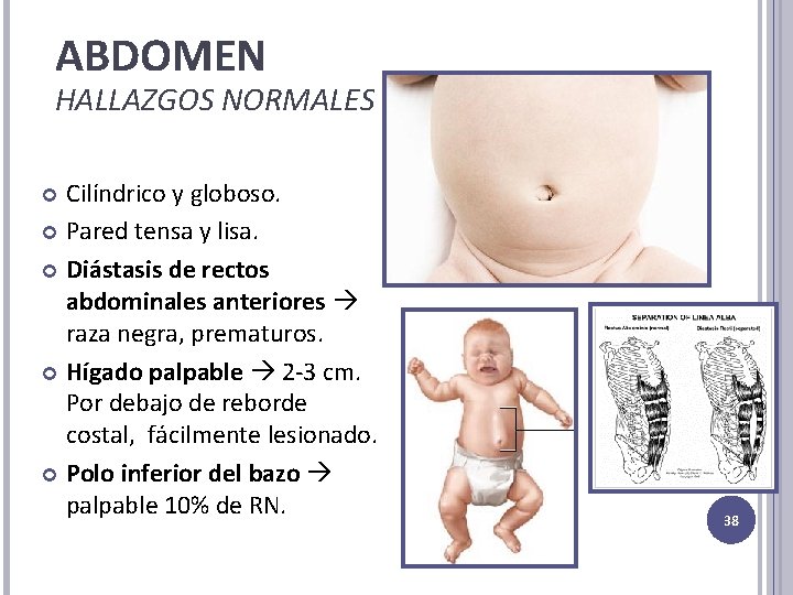 ABDOMEN HALLAZGOS NORMALES Cilíndrico y globoso. Pared tensa y lisa. Diástasis de rectos abdominales