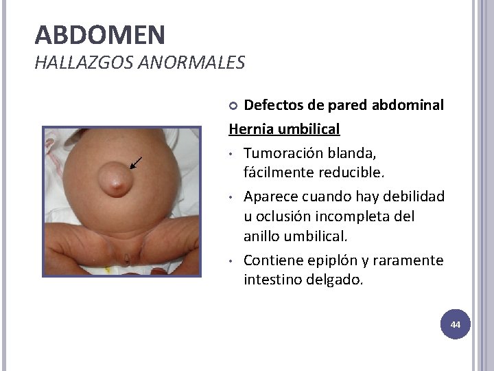 ABDOMEN HALLAZGOS ANORMALES Defectos de pared abdominal Hernia umbilical • Tumoración blanda, fácilmente reducible.