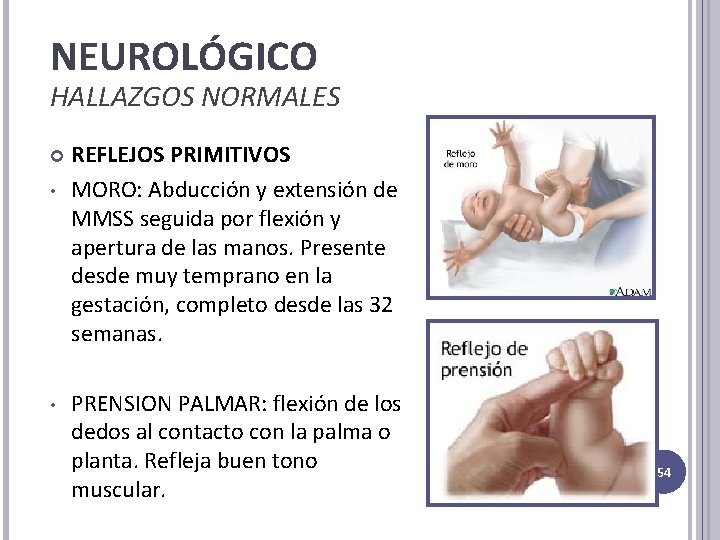NEUROLÓGICO HALLAZGOS NORMALES • • REFLEJOS PRIMITIVOS MORO: Abducción y extensión de MMSS seguida NEUROLÓGICO HALLAZGOS NORMALES • • REFLEJOS PRIMITIVOS MORO: Abducción y extensión de MMSS seguida