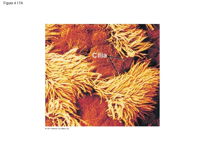 Figure 4. 17 A Cilia 