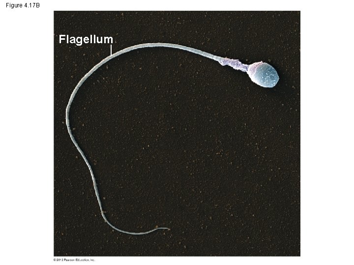 Figure 4. 17 B Flagellum 