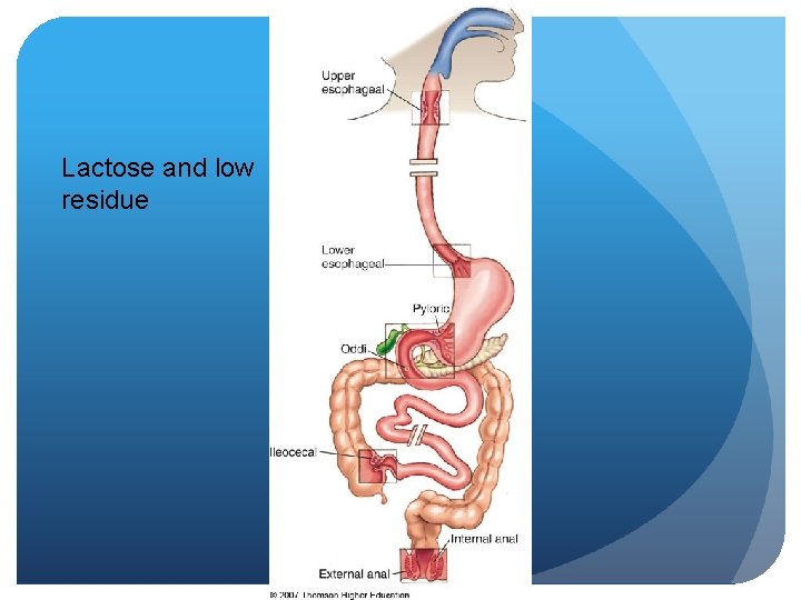 Lactose and low residue 