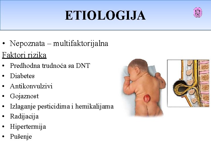 ETIOLOGIJA Etiologija • Nepoznata – multifaktorijalna Faktori rizika • • Predhodna trudnoća sa DNT ETIOLOGIJA Etiologija • Nepoznata – multifaktorijalna Faktori rizika • • Predhodna trudnoća sa DNT