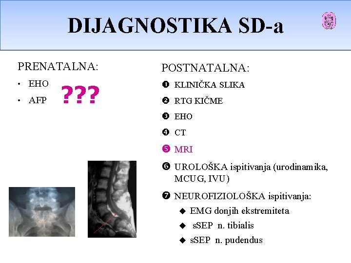 DIJAGNOSTIKA SD-a OSD-a PRENATALNA: POSTNATALNA: • EHO KLINIČKA SLIKA • AFP ? ? ? DIJAGNOSTIKA SD-a OSD-a PRENATALNA: POSTNATALNA: • EHO KLINIČKA SLIKA • AFP ? ? ?