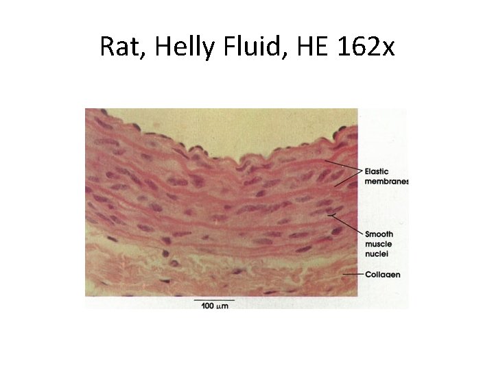 Rat, Helly Fluid, HE 162 x 