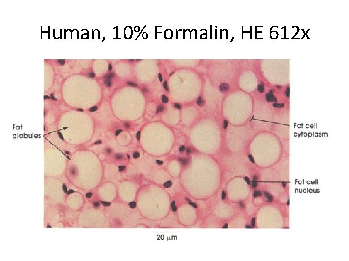 Human, 10% Formalin, HE 612 x 