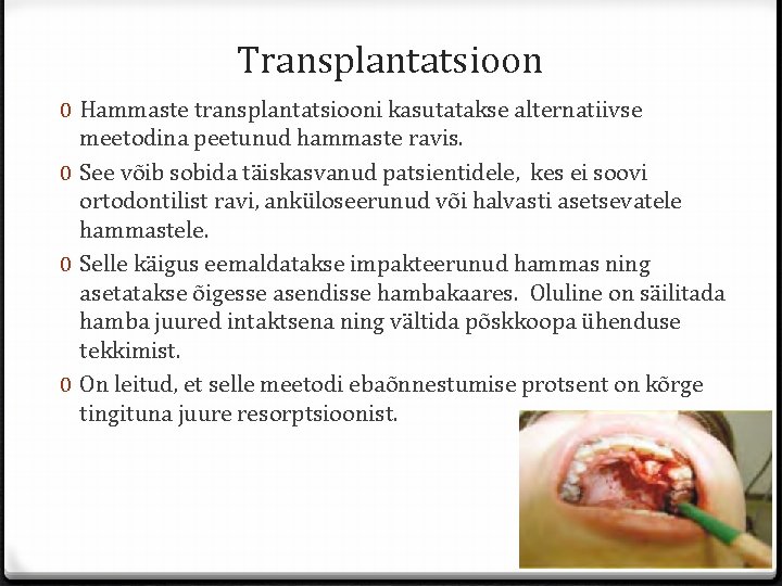 Transplantatsioon 0 Hammaste transplantatsiooni kasutatakse alternatiivse meetodina peetunud hammaste ravis. 0 See võib sobida