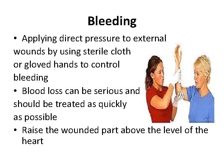 Bleeding • Applying direct pressure to external wounds by using sterile cloth or gloved