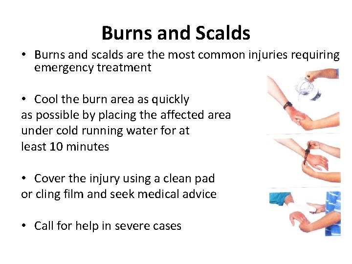 Burns and Scalds • Burns and scalds are the most common injuries requiring emergency