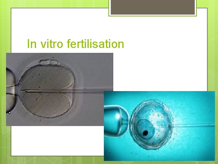 In vitro fertilisation In vitro fertilisation