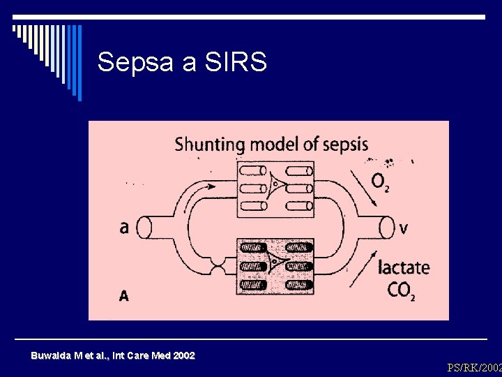 Sepsa a SIRS Buwalda M et al. , Int Care Med 2002 PS/RK/2002 