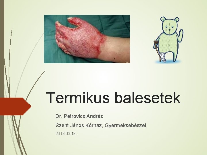 Termikus balesetek Dr. Petrovics András Szent János Kórház, Gyermeksebészet 2018. 03. 19. 