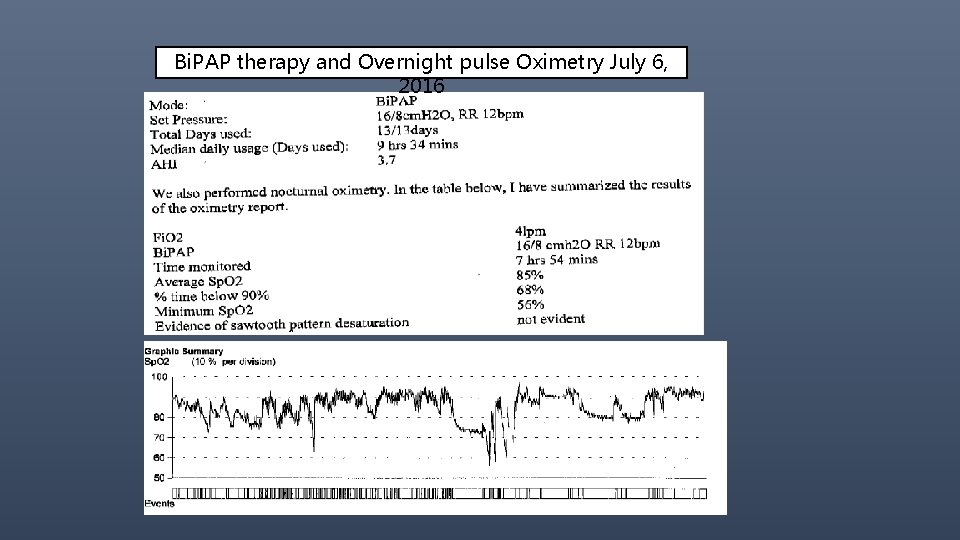 Bi. PAP therapy and Overnight pulse Oximetry July 6, 2016 